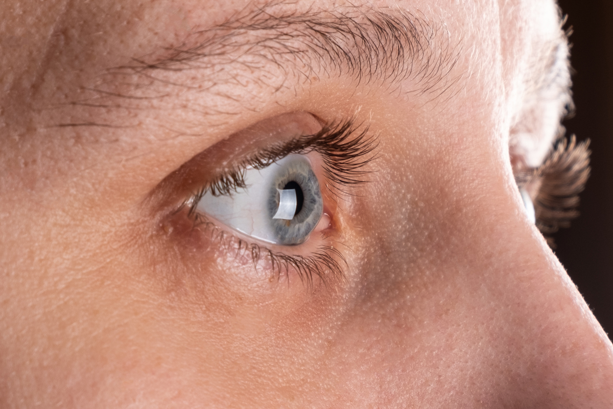 Corneal Transplant Options
