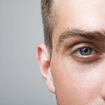 What Happens If You’re Not a Candidate for LASIK?