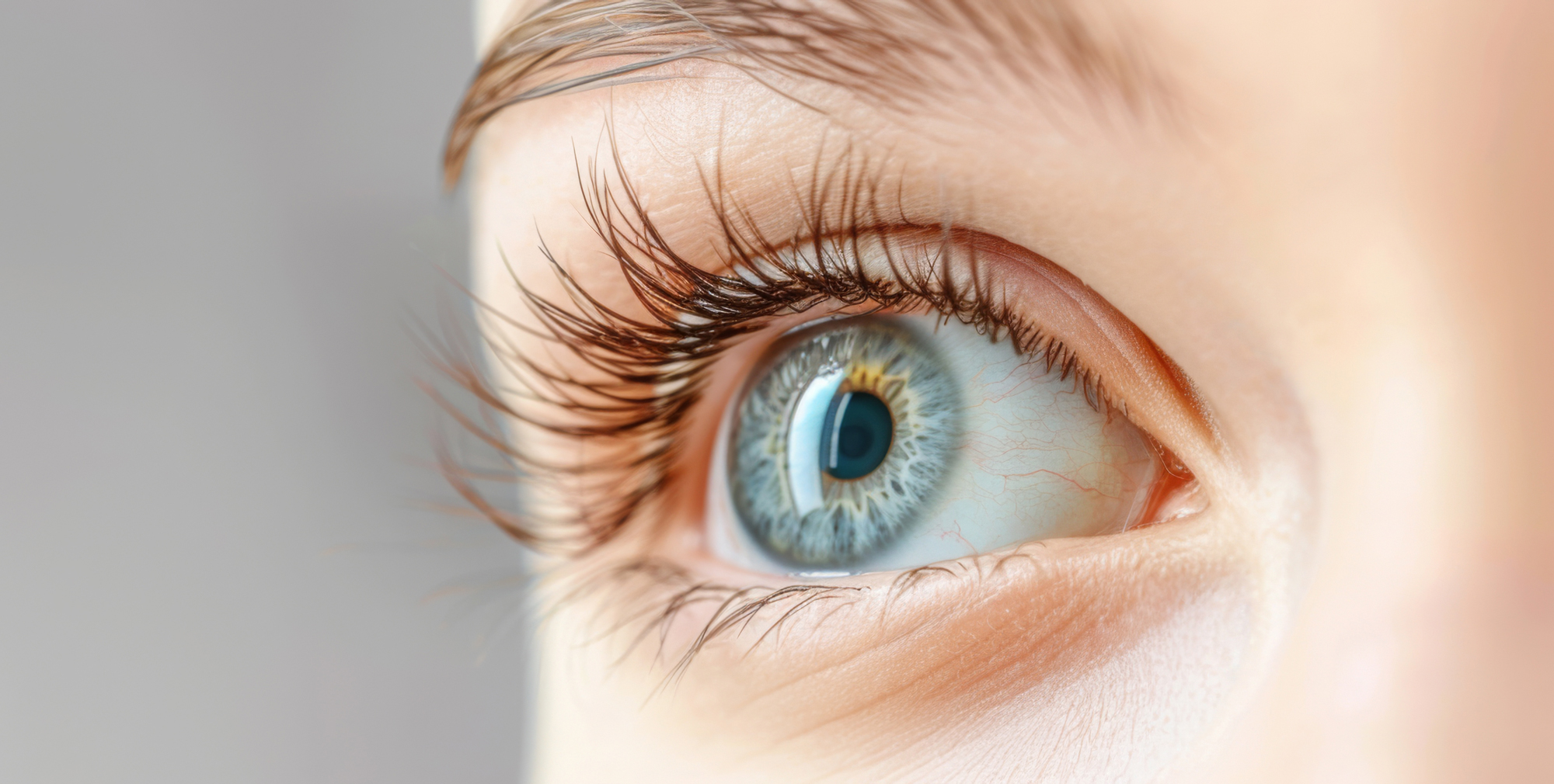Custom Lens Replacement (CLR) in the Bay Area